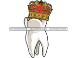 Golden Gold Crown On A Tooth JPG PNG Clipart Cricut Silhouette Cut Cutting
